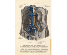 1912 год. Нижняя полая вена мужчины, старинная фототипия